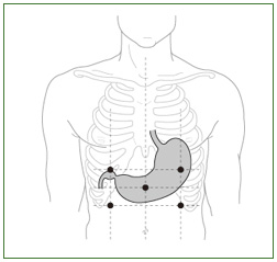 胃電図センサDL-162C
