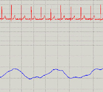 心電呼吸センサDL-320画面